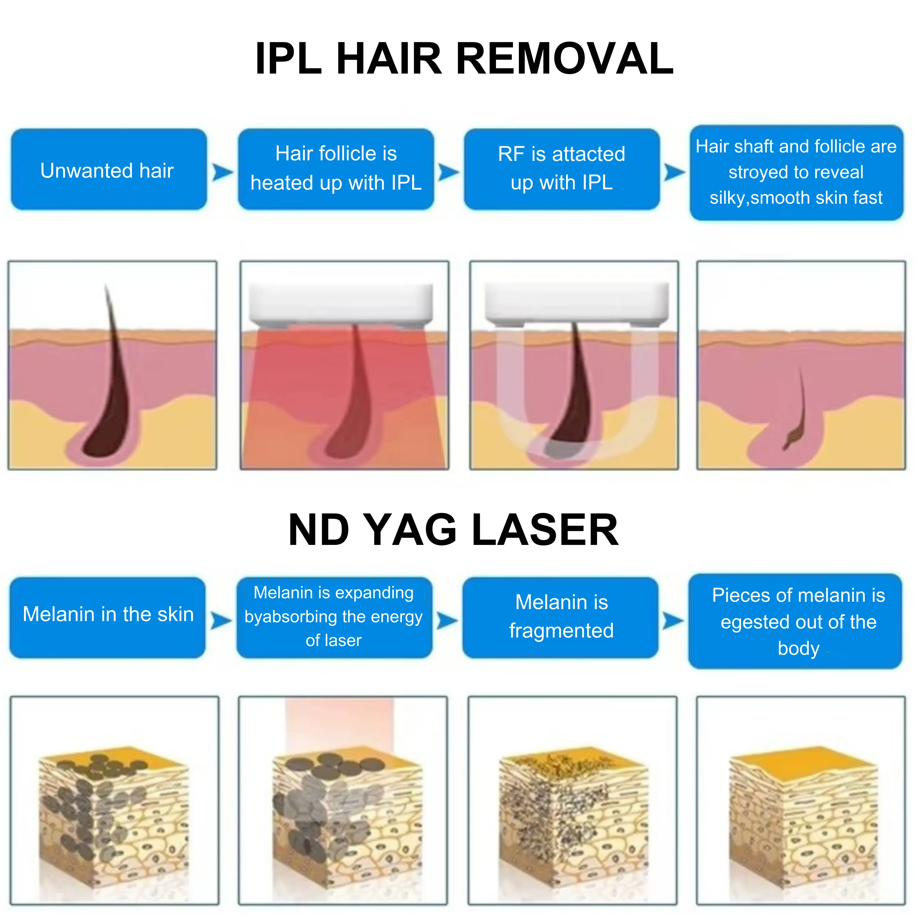 3-in-1 Laser Machine for Hair Removal + Tattoo Removal + E-Light Skin Rejuvenation - Image 4