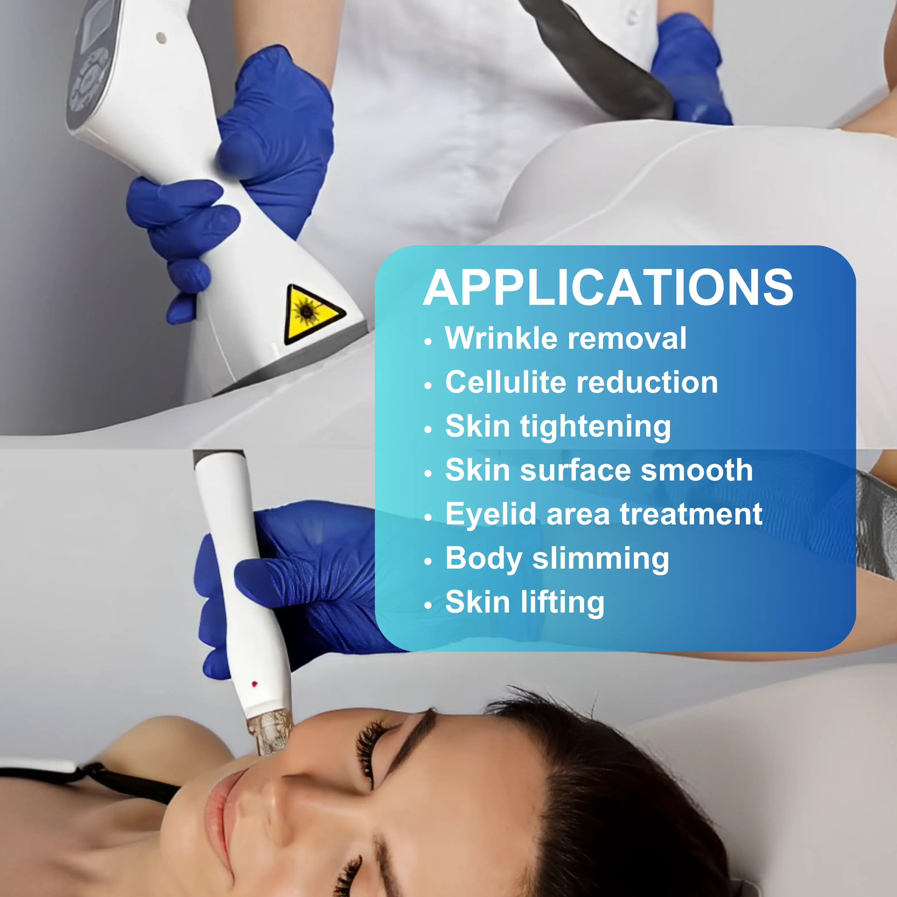4 In 1 Vera Vacuum Roller Massage Machine VeloLux - Image 4