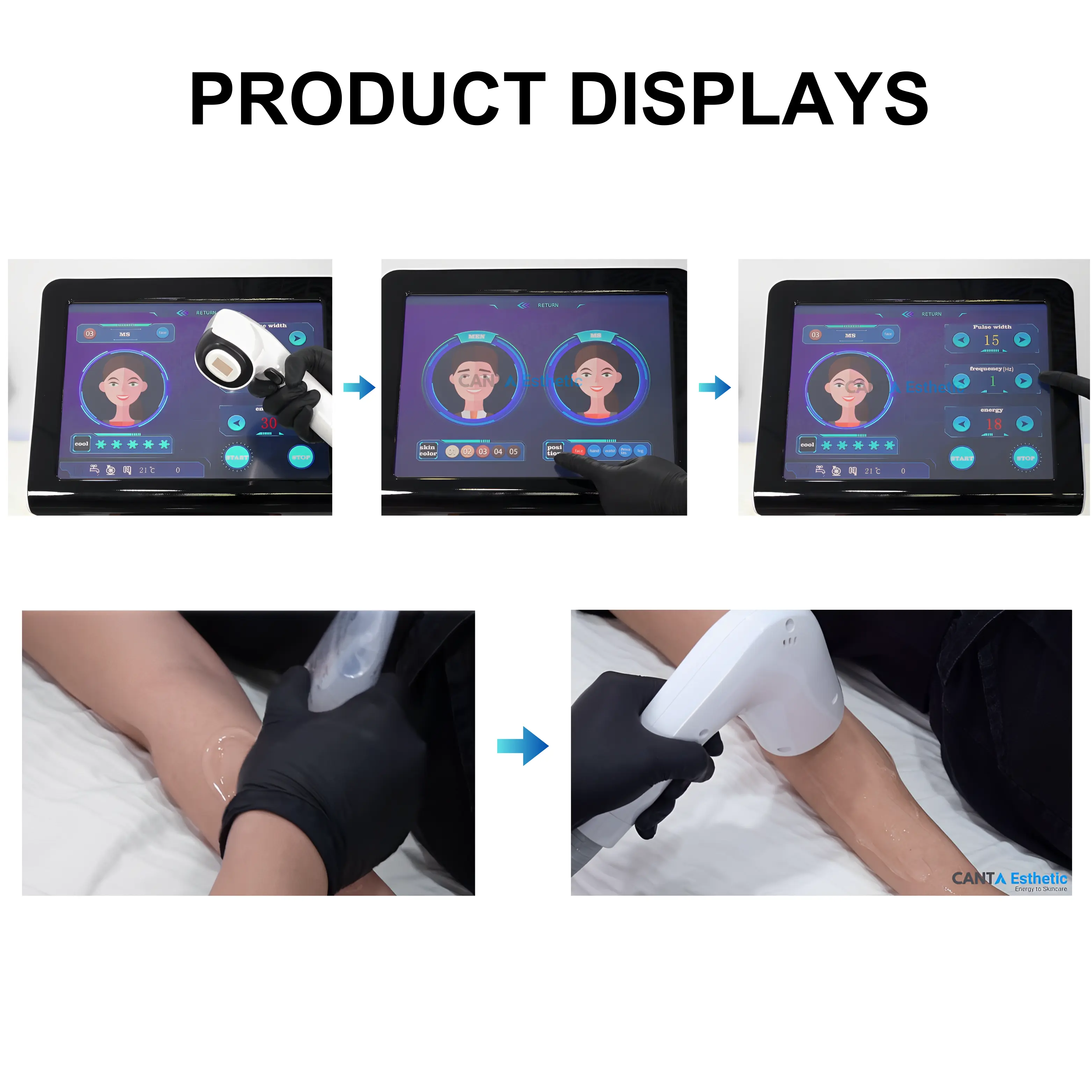 808 nm Diode Laser For Hair Removal LitePro - Image 5