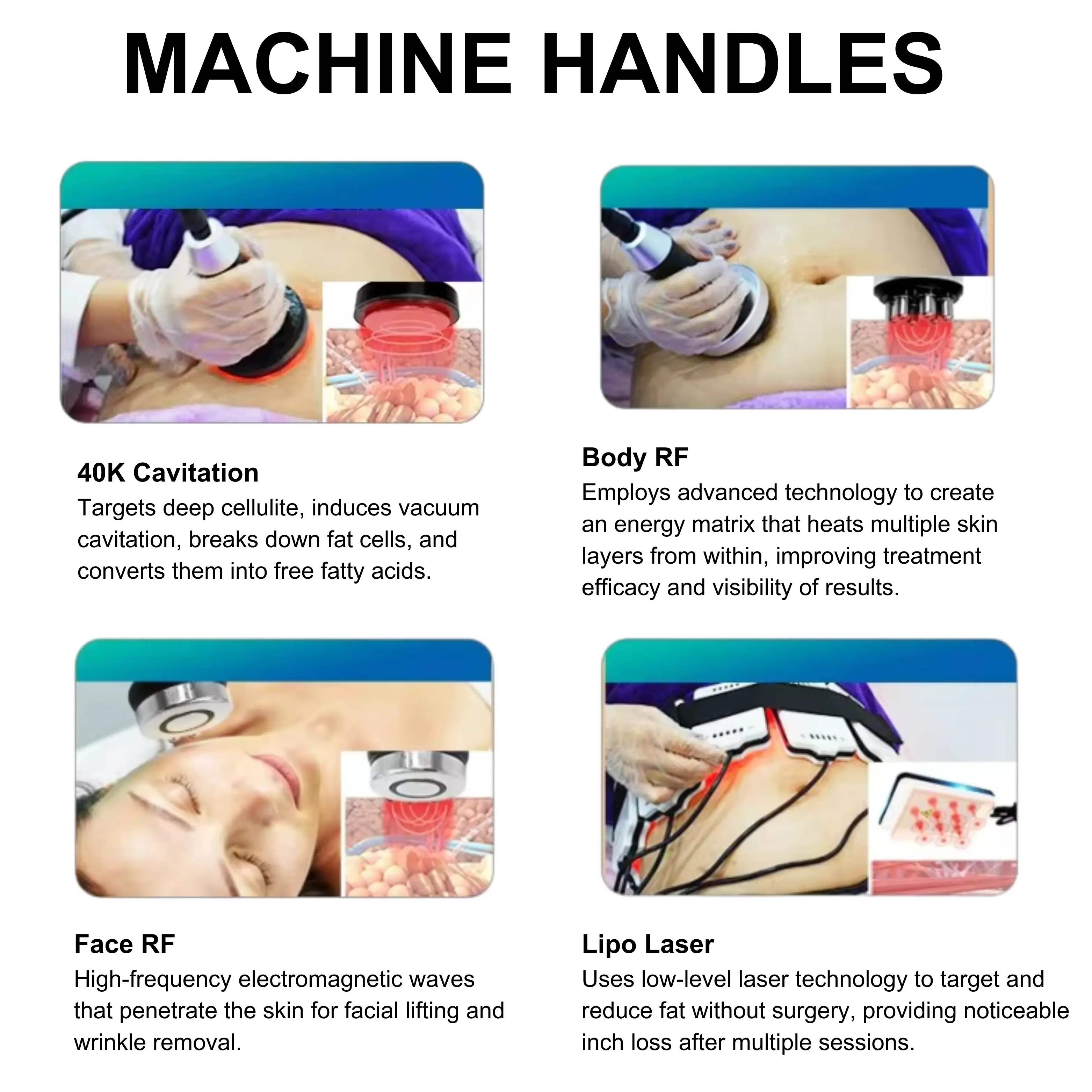 Cryolipolysis Machine for Fat Reduction and Skin Tightening - Image 4