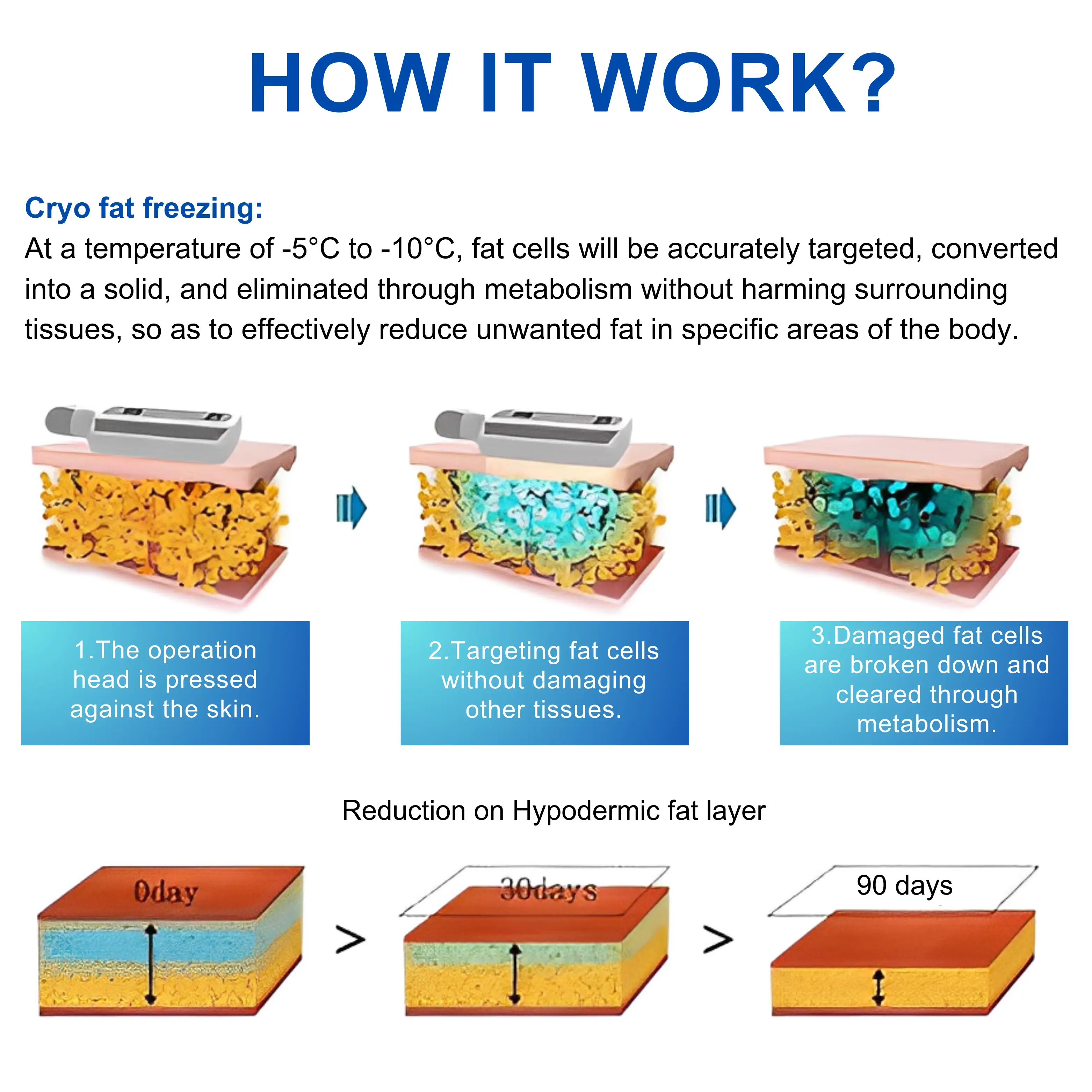 Cryotherapy Mahine with Cryo Boards - Image 3