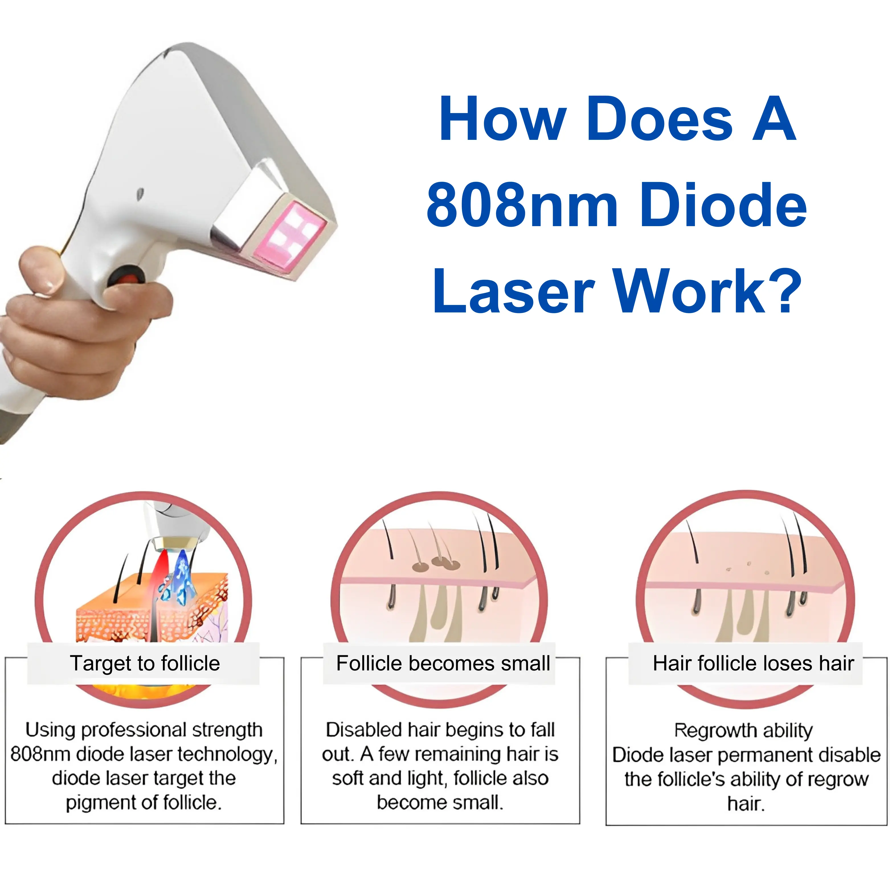 Diode Laser for Hair Removal Quikim 3 Wavelength - Image 4