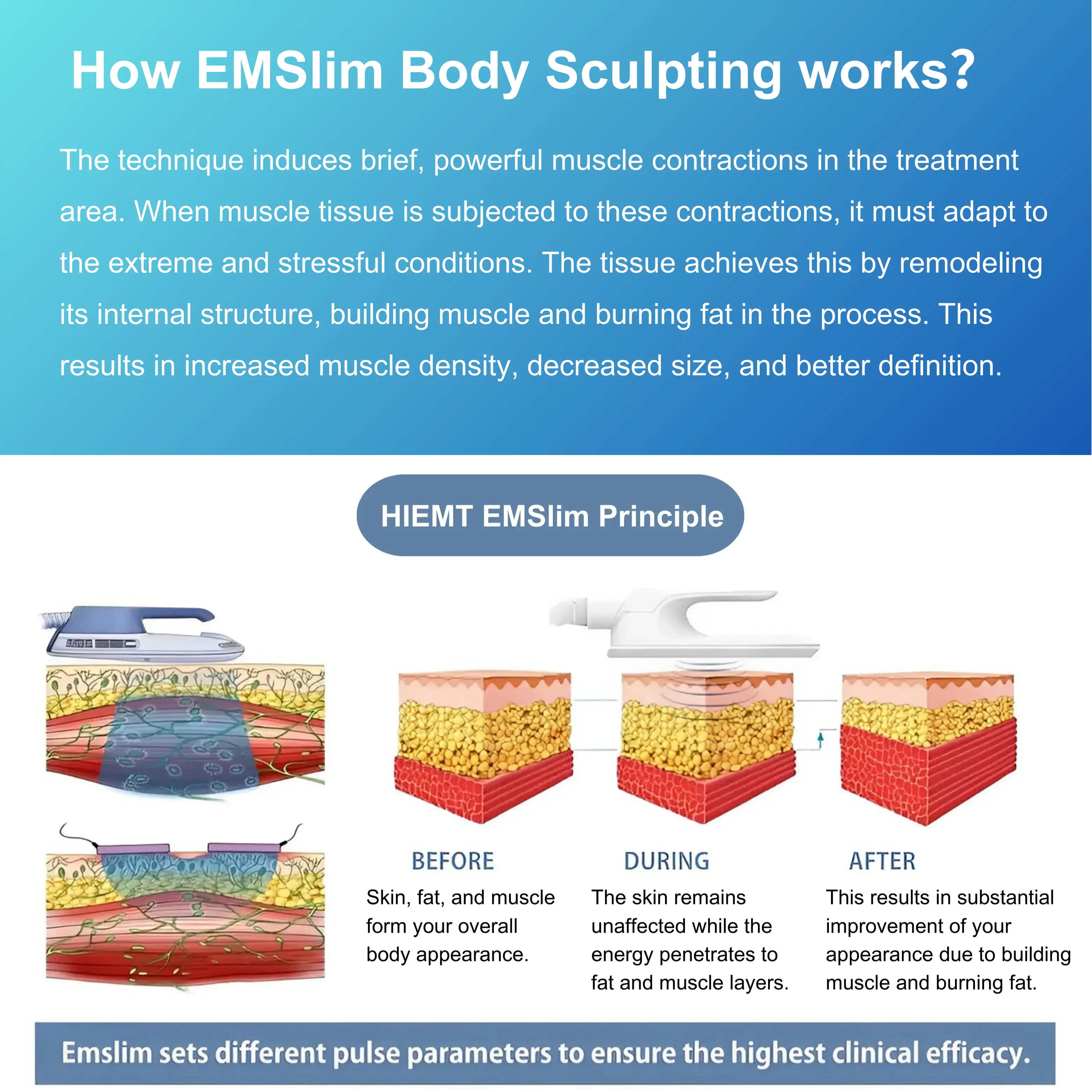 EMS Body Sculpt System with Cryotherapy 2 in 1 - Image 3