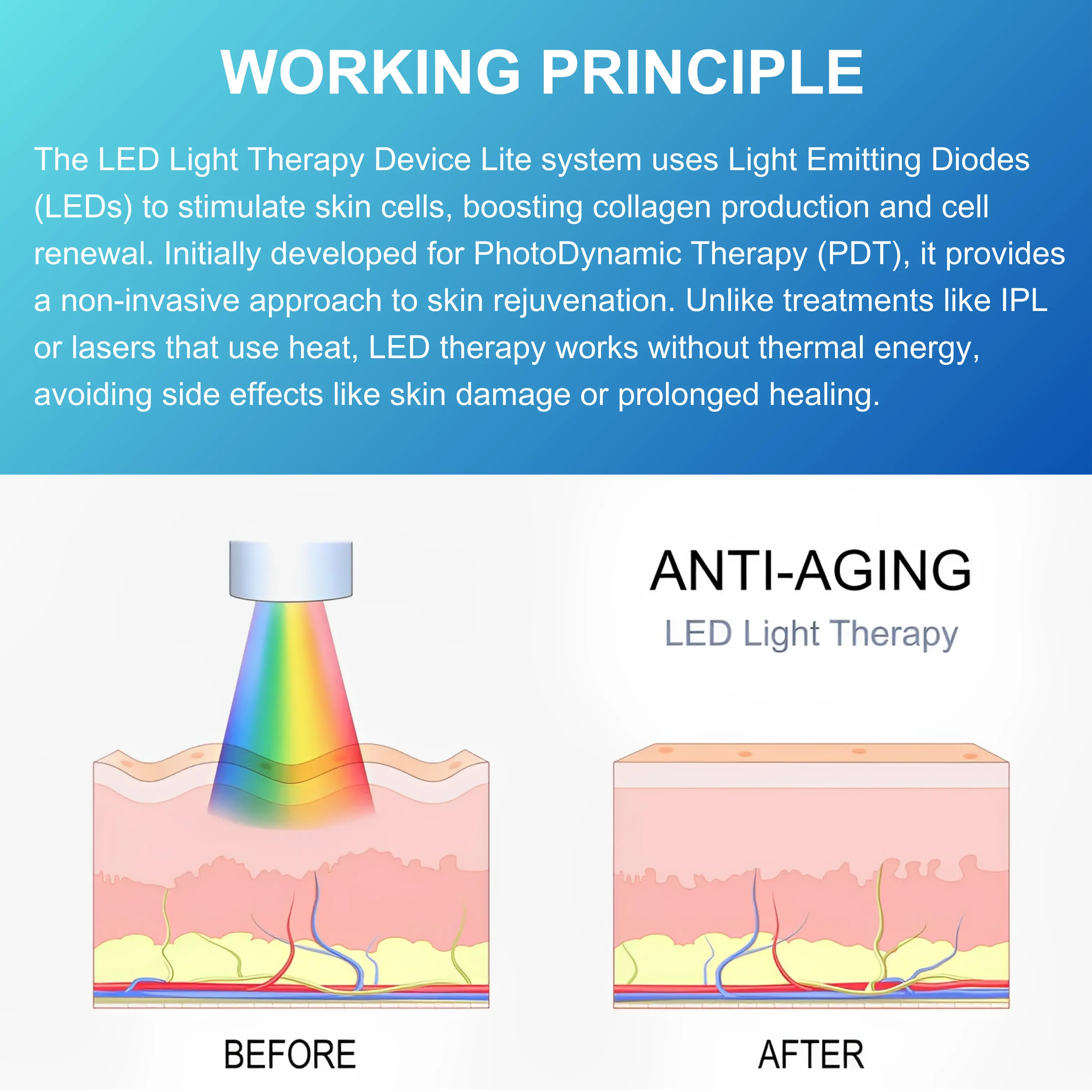 Led Light Therapy Device Lite - Image 3