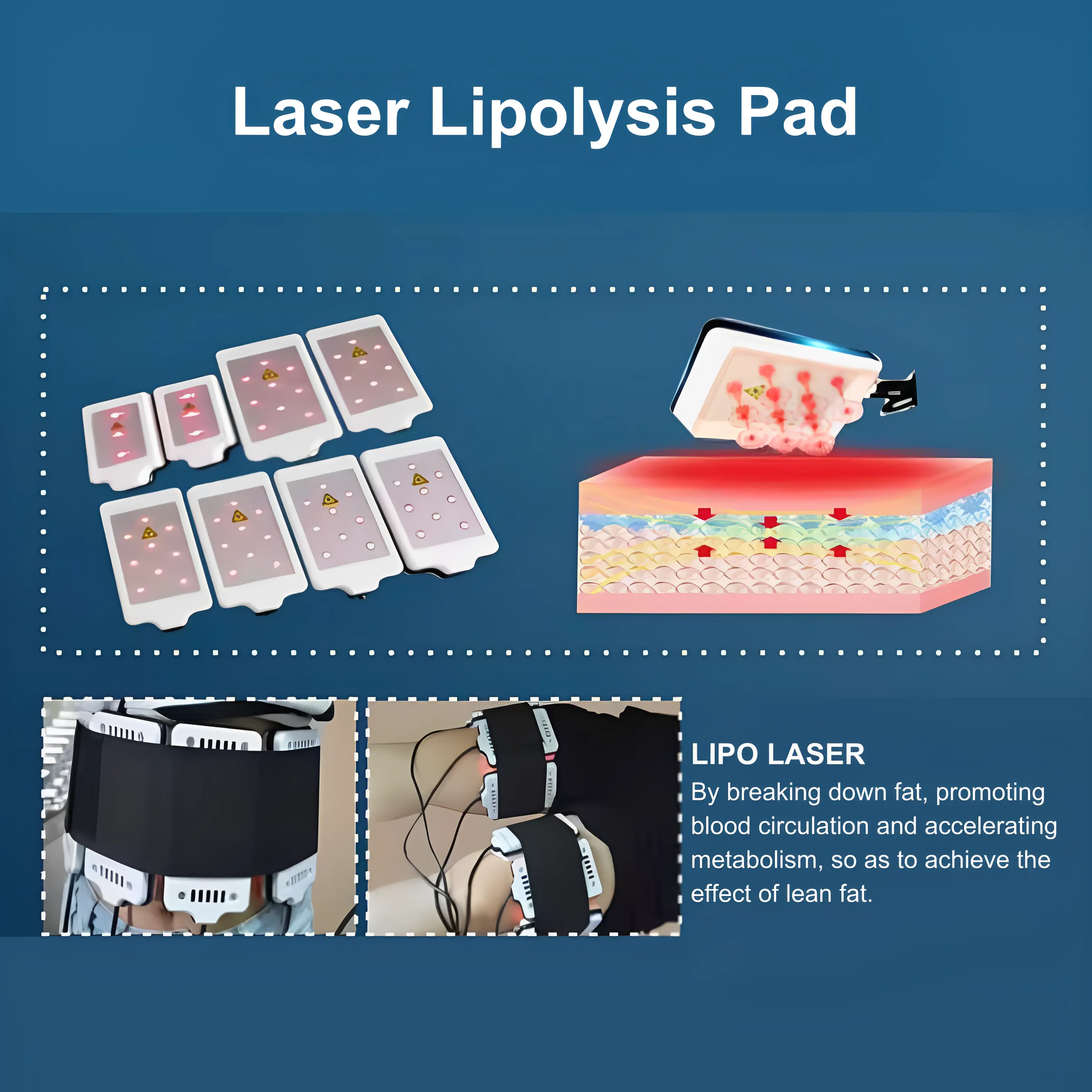 Lipo Laser 40K Cavitation Slimming Machine 6 in 1 - Image 5