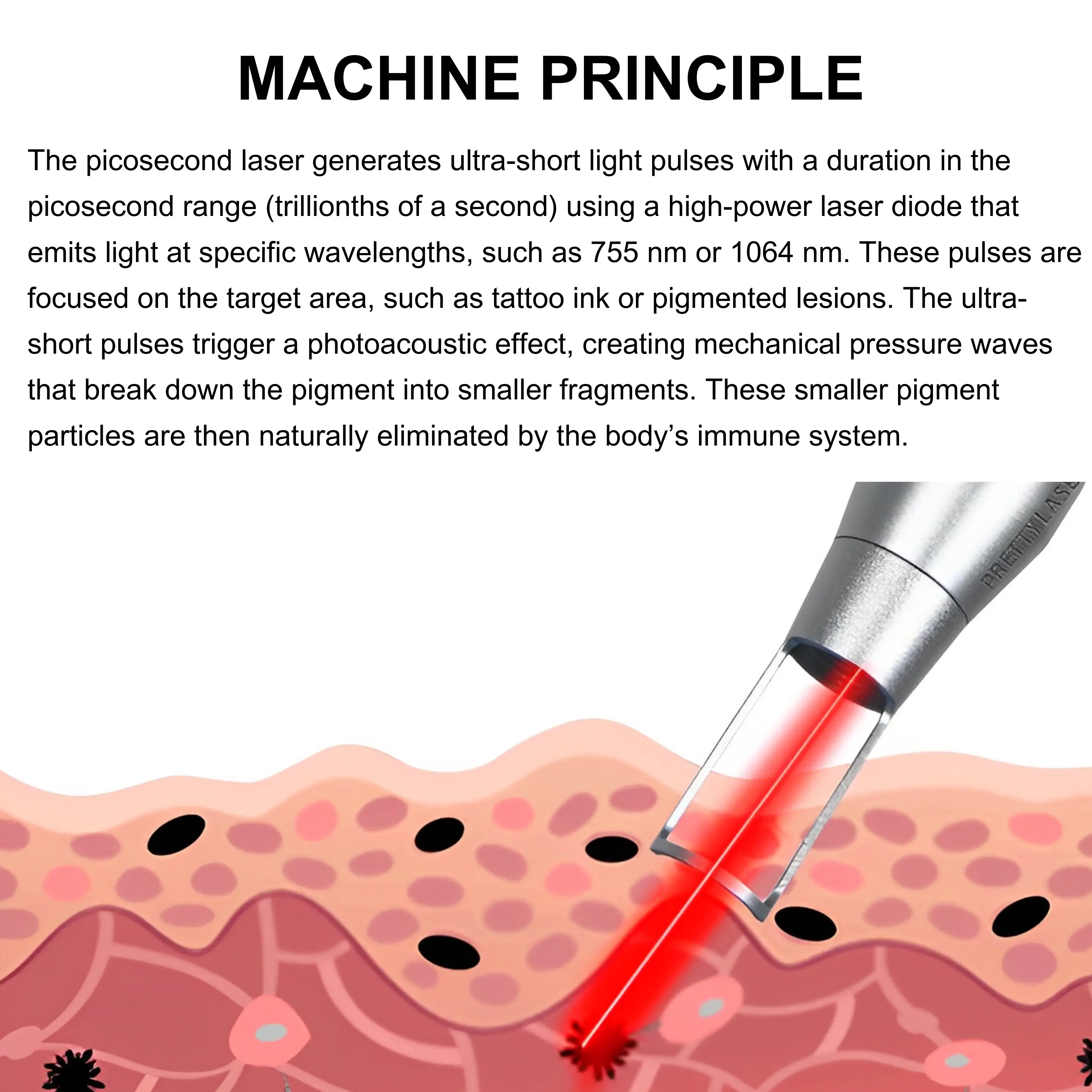 Pico-LITE Professional Picosecond Laser Tattoo Removal Device - Image 3