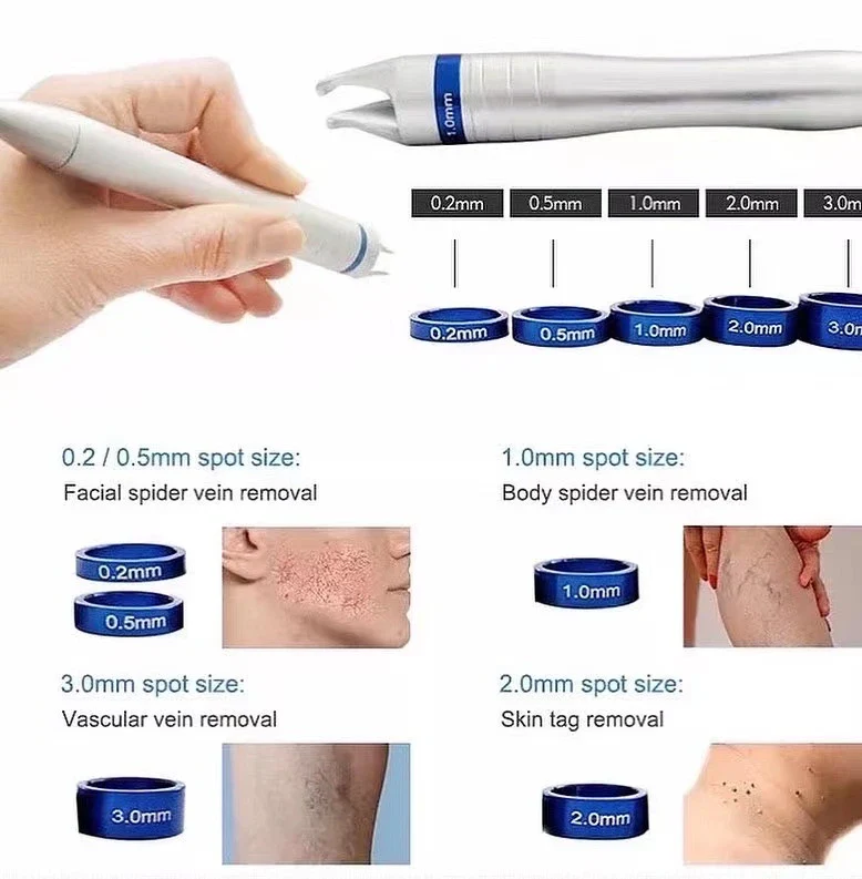 Spider Veins Laser Removal Machine 980nm Diode Laser - Image 3