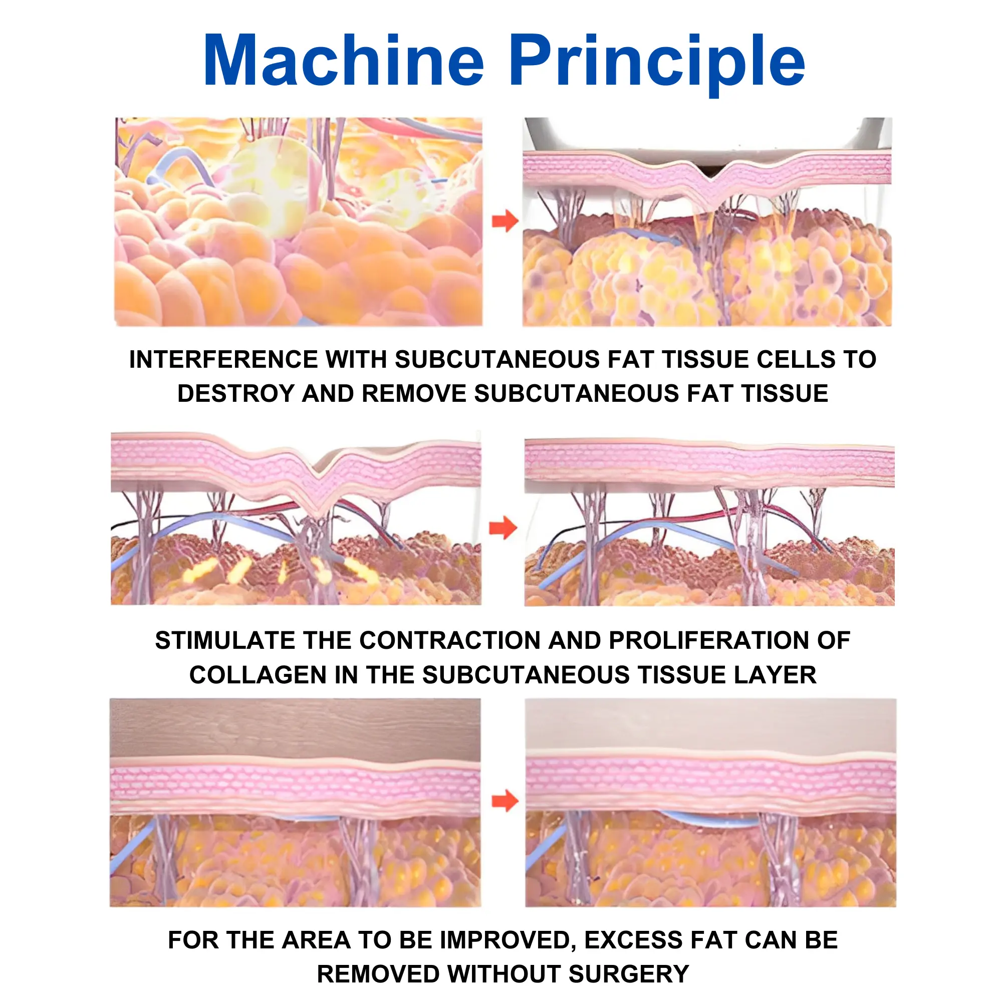 Vera Body Shape Sculpitng System X10 - Image 3